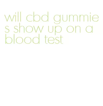 will cbd gummies show up on a blood test