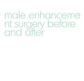 male enhancement surgery before and after