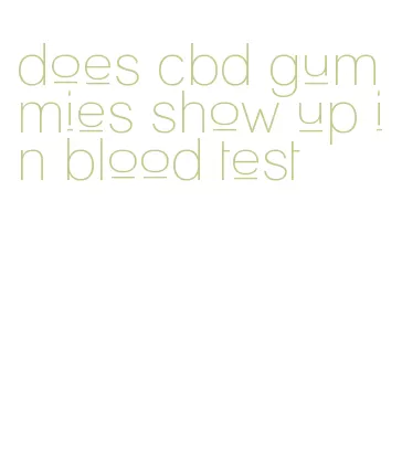 does cbd gummies show up in blood test